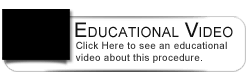 Dental Education Video - Precision Partials